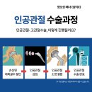 임실정형외과 이미지