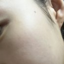 피네의원 이미지