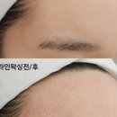 송헤어라인 - 도봉구 | 송헤어라인