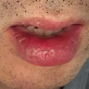 대학로동물병원 | 대학로 카라성형외과 입술 봉합 후기｜축구 연습 중 입술 찢어짐 응급 방문