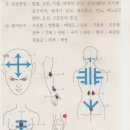 골반염 요통 뒷다리통증 괄사 벌침치료 이미지