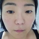 피부활력화장품 클로레 스노우 CO2 솔루션 키트 카복시팩 찐후기