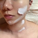 케어메디칼 | 미금역 피부관리 <루오나에스테틱> 메디컬장비 맞춤 케어 후기