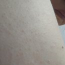때수건 대신 선택한 플루 바디 스크럽, 낫포유 클리어 모공각화증 내돈내산 후기.