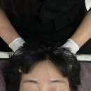 더 미쁘다 | 구미피부관리 미쁘다뷰티에서 플라즈마 멀티 관리 후기