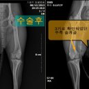 짱아PC 이미지