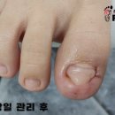 레푸스 사상점 이미지