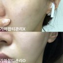 오픈] 피부과 무엇? 홈케어끝판왕 보톡스리프팅/예민진정/기미잡티 세럼&amp;앰플 : 후기만족도99% 재구매율99%
