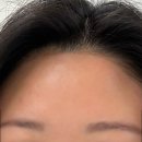 진헤어라인 - 예산군 삽교로 114 | [대구 슈가링왁싱] 카모뷰티에서 페이스왁싱(인중, 헤어라인, 구렛나루) 받고 깔끔해진 후기!