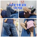 예천정형외과의원 | 안동 도수치료 / 고관절 무릎 골절 통증/ 안동 도수치료 후기