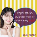 바비한의원 이미지