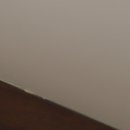 웰플란트75치과의원 이미지