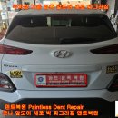 현대 코나 앞도어 주차장 기둥 접촉 찌그러짐 구멍 뜷지 않고 이쁘게 덴트복원 방배동덴트 서초구덴트 서울덴트복원 이미지