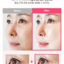 메디핑거