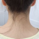 태흥약국 | 저자극 의정부역왁싱 찾으신다면 모두올왁싱 가보세요