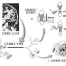 단월드 건강정보 - 여전히 풀리지 않는 퍼즐 '치매' 이미지