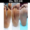 크린톡효소 네이버블로그