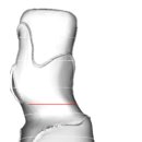 보조기전