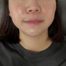 뷰티온의원 | 통영 피부과 &lt;뷰티온의원_통영점&gt;