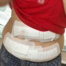 체인지의원 | 매일 상상했던 쉬운 다이어트, 신사 복부지방분해주사 의원 "3회차" 후기(시술 전, 1~3회차 사진 비교)