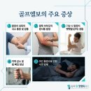 송파원정형외과의원 네이버블로그
