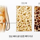 씨에스나무병원 네이버블로그