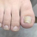 레푸스 감삼점&에이레네 이미지