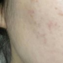 유한회사 청정클린 | 수부지 피부 관리 보습 크림 한달 후기