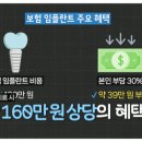 라인아치 치과기공소 | 풀아치가격? 실토합니다