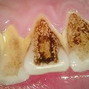 양평백상치과의원 네이버블로그