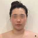 피부,빛나리 이미지