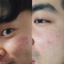하율 | 피부관리실제품ㅣ닥터쌤 시카엑소 피디알엔 리턴세럼 연어세럼 하율코스메틱 후기