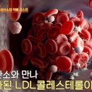 세모스쿠알렌 이미지