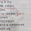 최비뇨의학과의원 | 백민기 아이사랑 비뇨의학과의원 후기 수신증 or 물혹