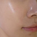 루온 에스테틱 이미지