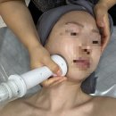 안면축소받으러 천안피부관리샵 천안가인뷰티에스테틱 방문 후기