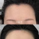 싸다고 | 김천헤어라인문신, 싸다고 갔다가 망한 후기 보고도 괜찮으세요?