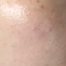 (유)메디컬준 | 수분 마스크팩 추천 위드유스킨 편백 마스크 10매 진정 보습 데일리팩 후기