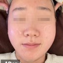 아이섭 이미지