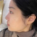 브로우 현