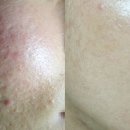 보떼비알 이미지