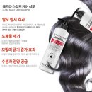 두피탈모관리