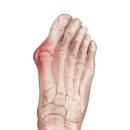 짐앤테라피 피티 이미지