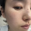 보닉스 샤인 스킨부스터세럼