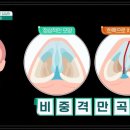 시원한이비인후과 - 부산진구 전포대로200번길 27 | 시원한이비인후과