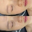 에이엠메디 | [연산동피부관리]에이에이엠뷰티/A.A.M beauty 스킨디톡스 후기