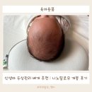 신생아부터 사용 가능 한 아기 두상 베개 추천 : 니노 필로우 개봉 후기