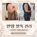 안양 팔뚝 지방분해주사, 리라핏 내돈내산 후기