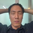 레가토 - 연수구 벚꽃로142번길 34 | 부산여드름흉터치료, 효과 좋은 새살침 3회차+레가토 후기!