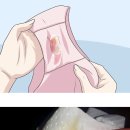 아마존여성의원 이미지